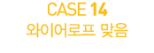 CASE 14          