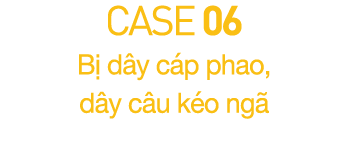 CASE 06  B  d y c p phao, d y c u k o ng 