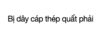 CASE 03  B  d y c p th p qu t ph i 