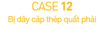 CASE 12  B  d y c p th p qu t ph i