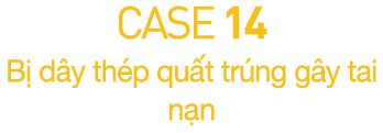 CASE 14  B  d y th p qu t tr ng g y tai n n